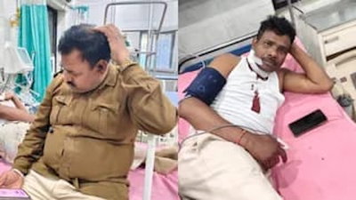 चाईबासा: उत्पाद विभाग की टीम पर हमला, एएसआई गंभीर रूप से घायल