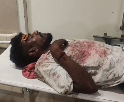 Jamshedpur News: जेम्को बाजार में युवक पर हमला, धारदार हथियार और लाठी-डंडों से पीटा, गंभीर